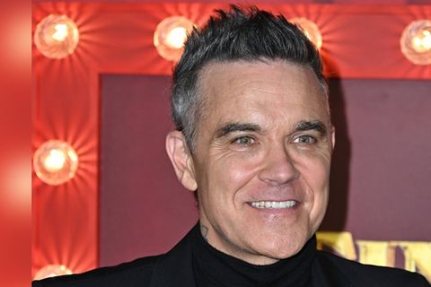 Robbie Williams ließ sich vor zwei Jahren Veneers einsetzen.