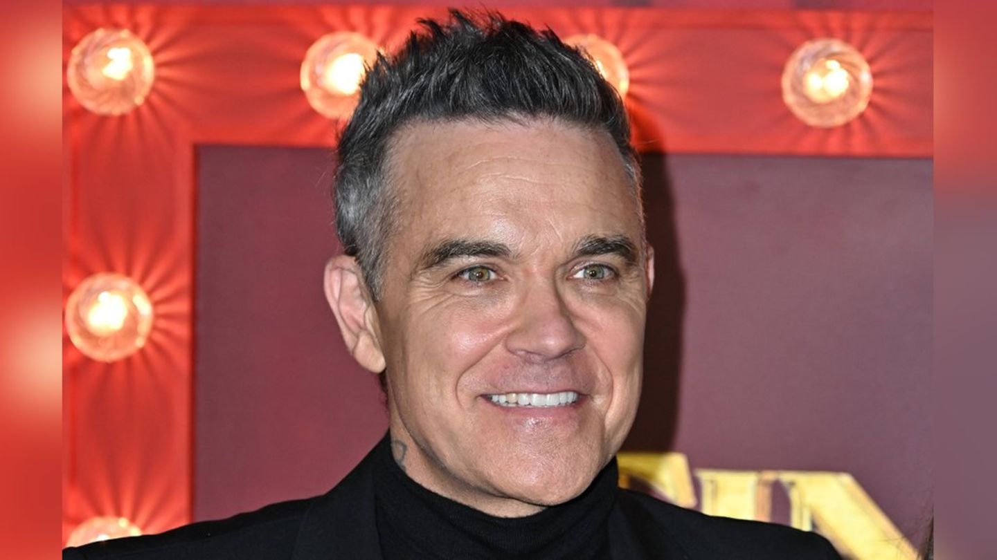 Robbie Williams ließ sich vor zwei Jahren Veneers einsetzen.
