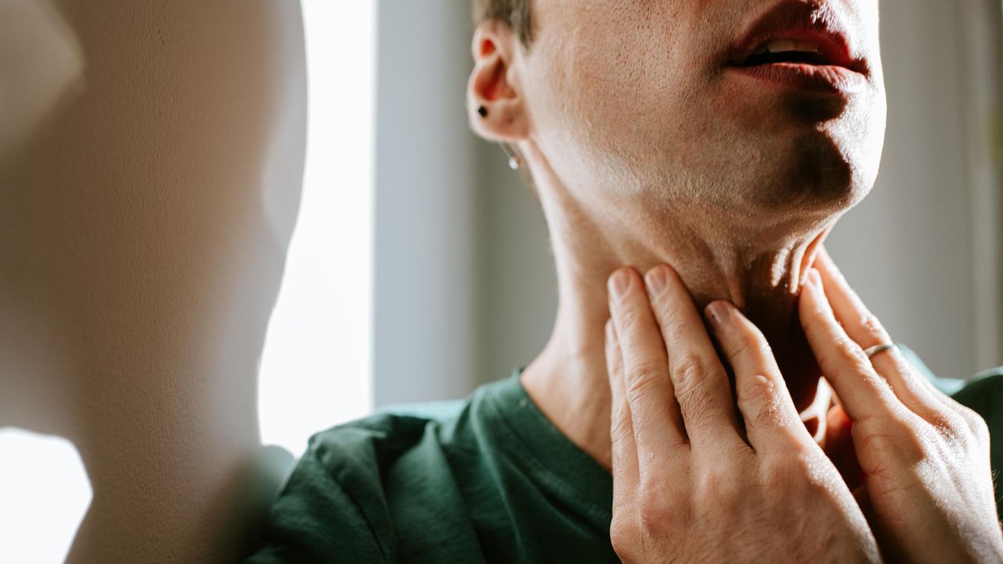 Das HPV-Virus kann Mundrachenkrebs verursachen. Ein mögliches Anzeichen: dicke, harte Lymphknoten am Hals (Symbolbild)