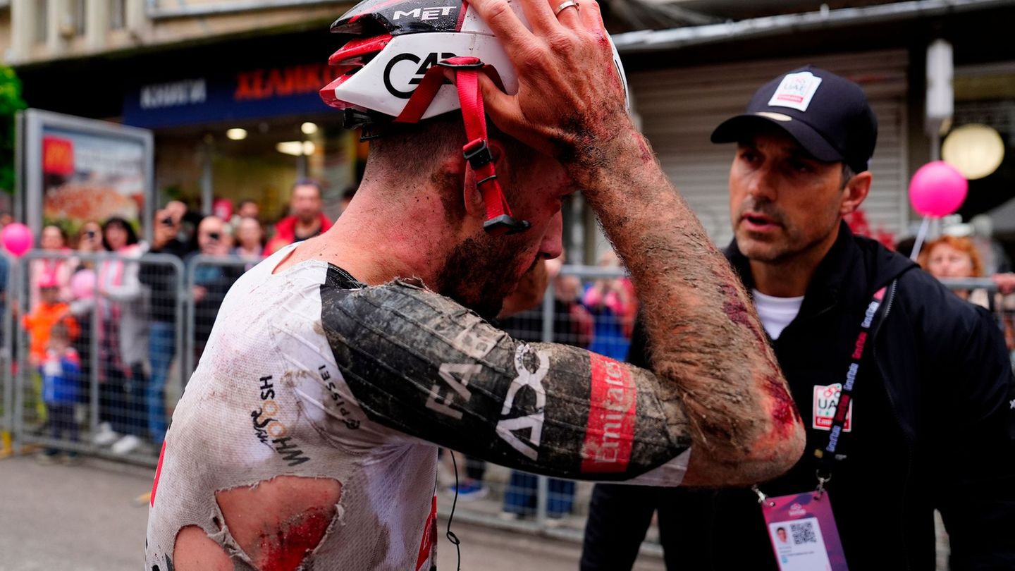 Mitfavorit Adam Yates stürzte beim Giro d'Italia schwer. Foto: Fabio Ferrari/LaPresse/AP/dpa