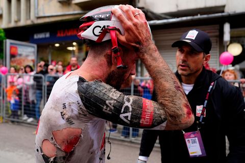 Mitfavorit Adam Yates stürzte beim Giro d'Italia schwer. Foto: Fabio Ferrari/LaPresse/AP/dpa