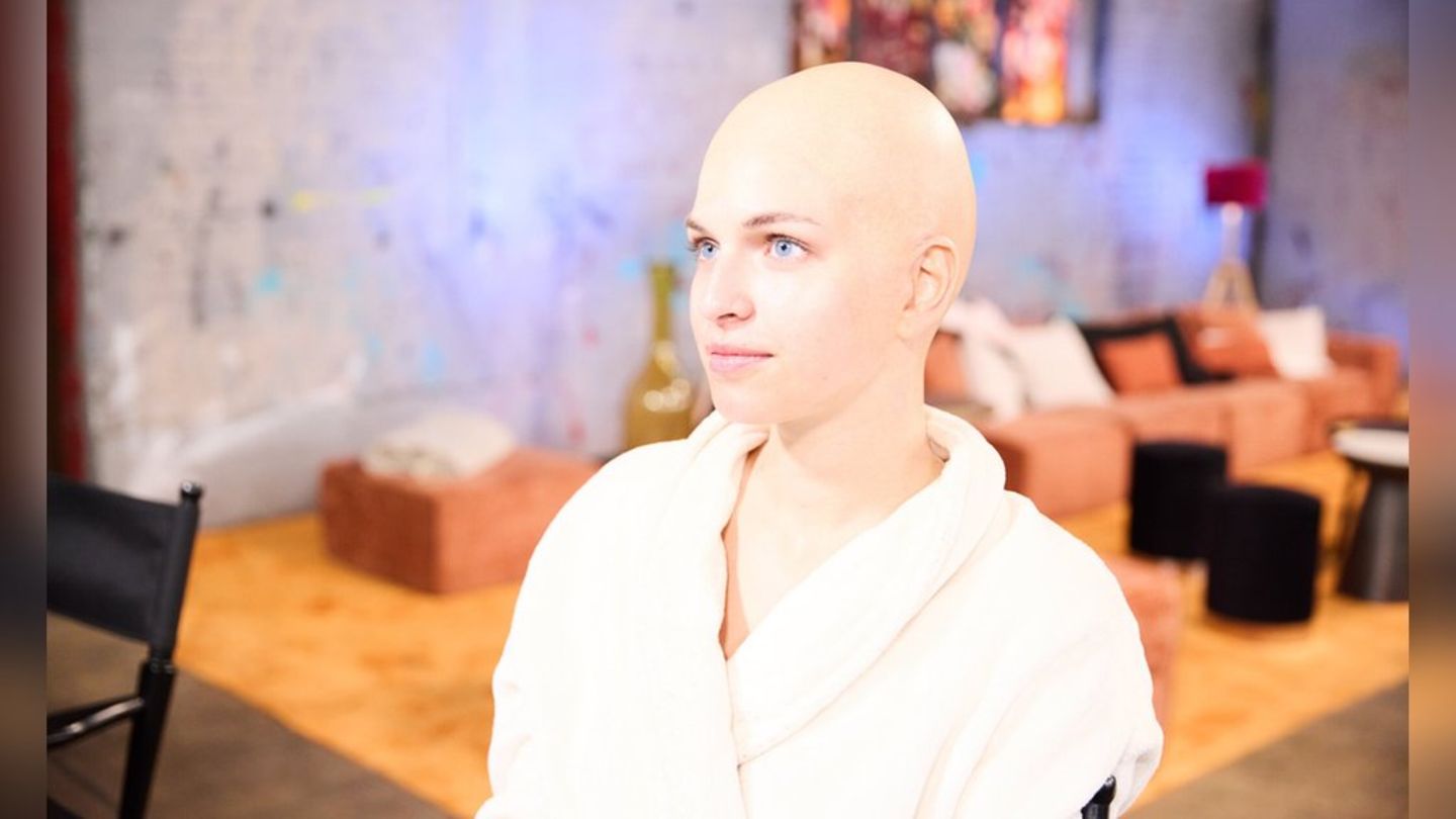 Extreme Typveränderung: Model Anna mit Glatze.