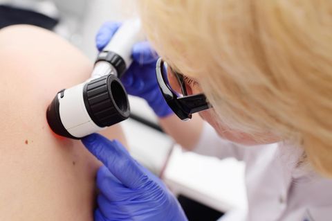 Wir nennen Ihnen ausgezeichnete Kliniken im Bereich Hautkrebs