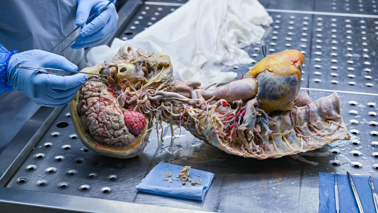 In der Werkstatt im brandenburgischen Guben entstehen die Plastinate der Organe. (Archivbild) Foto: Patrick Pleul/dpa