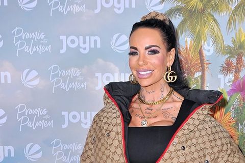 Gina-Lisa Lohfink spricht über die Folgen einer verheerenden Schönheitsoperation.