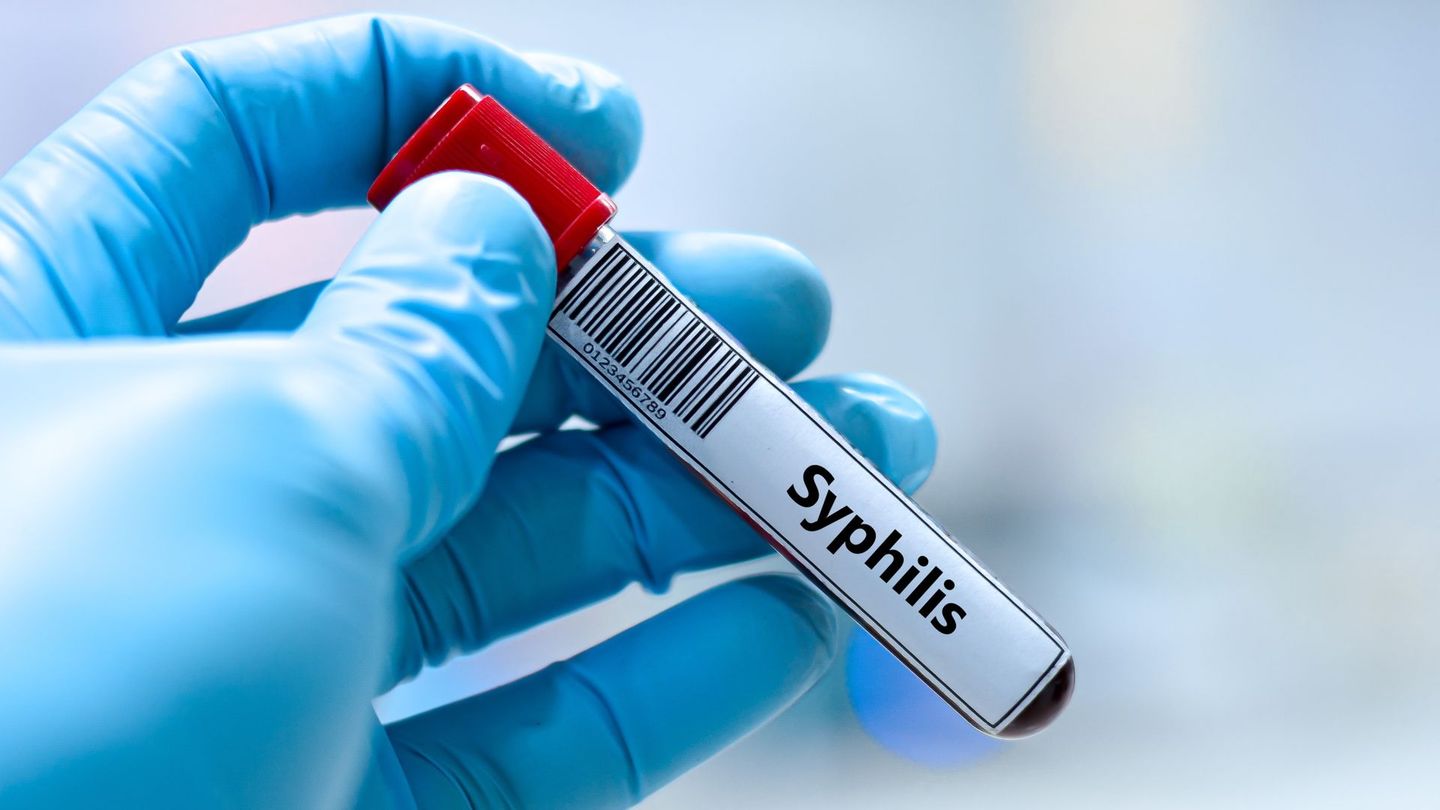 Unbehandelte Geschlechtskrankheiten wie Syphilis können die Gesundheit stark beeinträchtigen.
