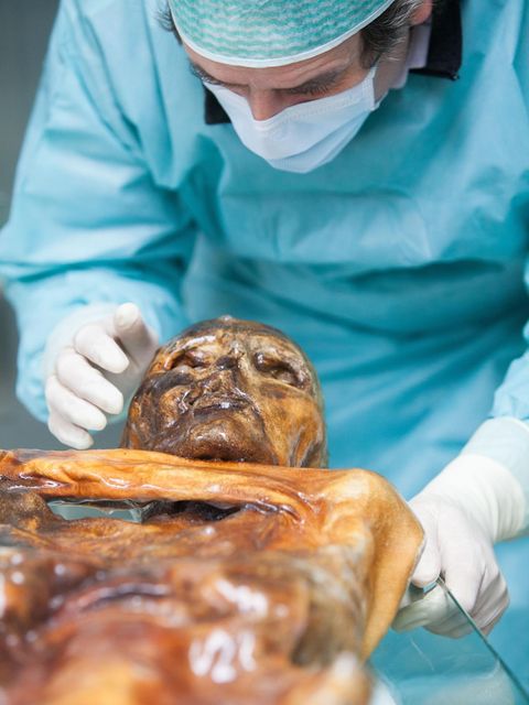Forscher entschlüsseln Ötzis Mikrobiom