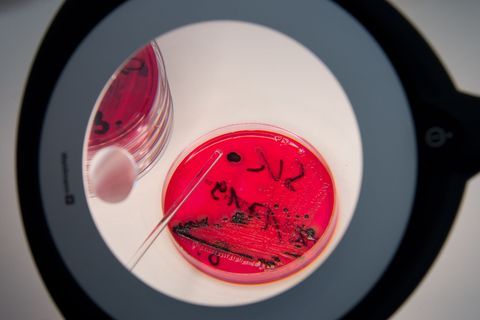 Die Zahl der unter anderem von Salmonellen verursachten Magen-Darm-Erkrankungen hat sich in Schleswig-Holstein erhöht. (Archivbi