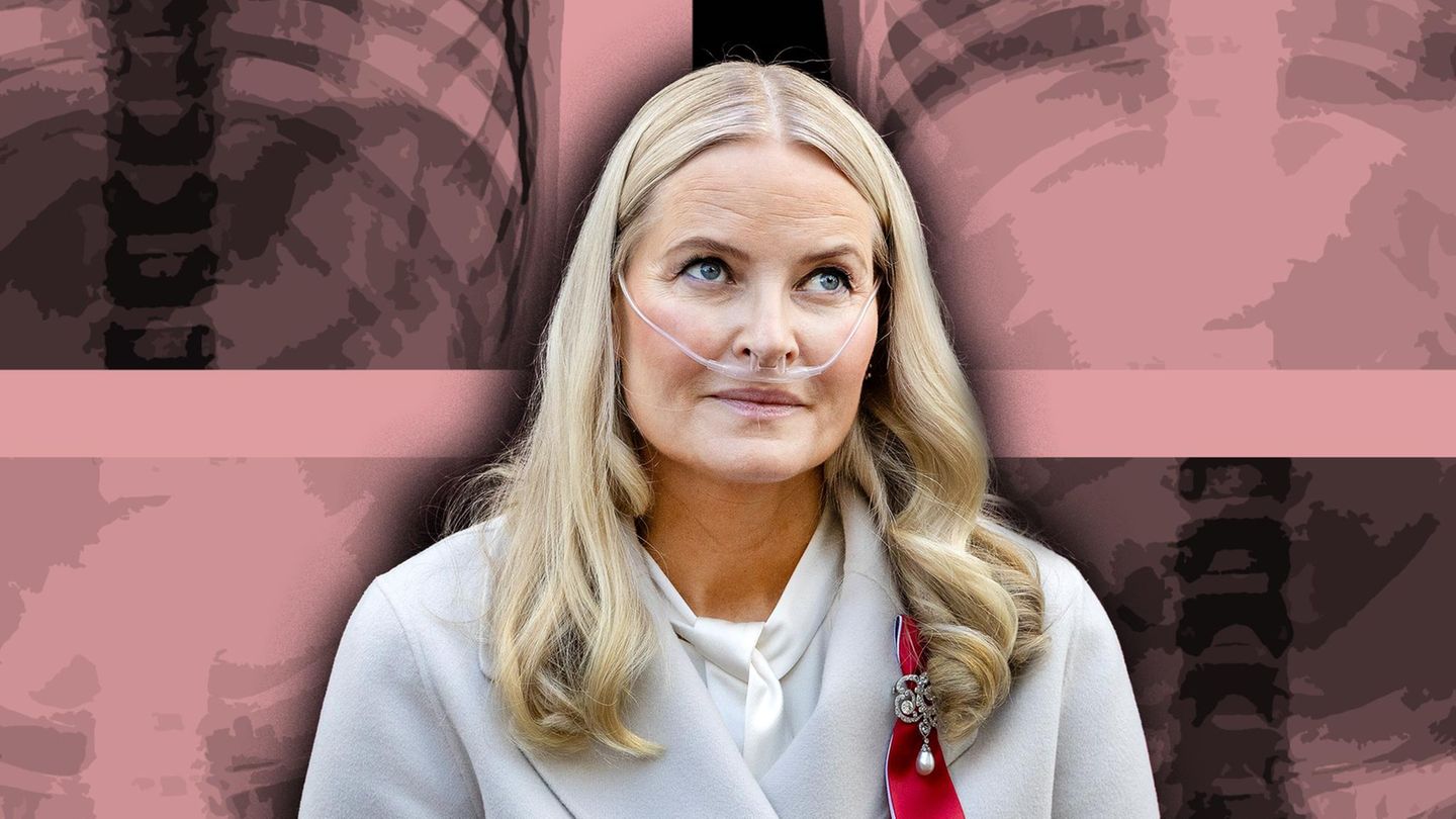 Lungenfibrose: Wie die tödliche Krankheit verläuft – und worauf Mette-Marit hoffen kann