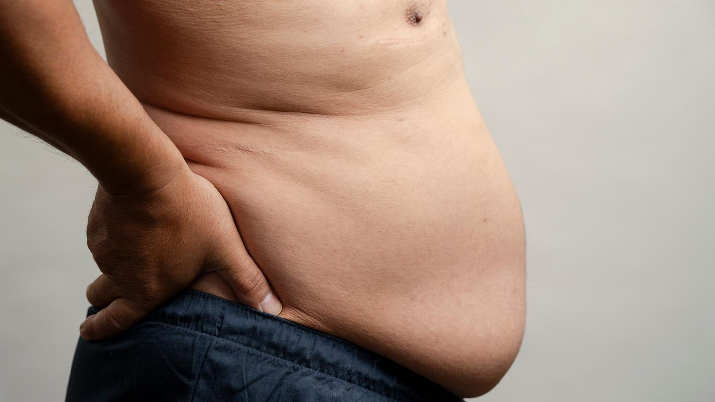 Fettleibigkeit : Wie Übergewicht das Krebsrisiko steigert