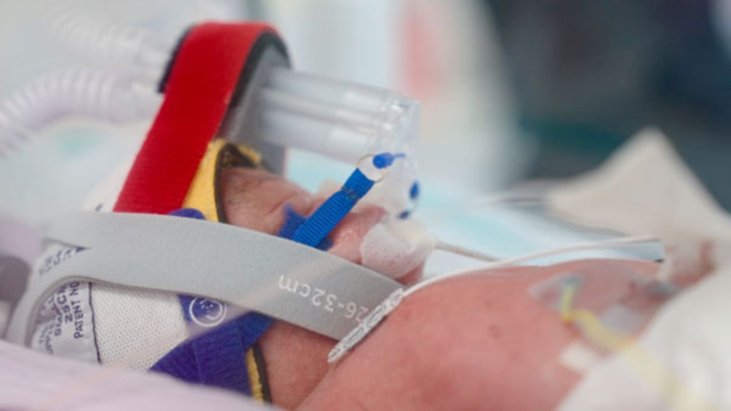 Quadruplets cause medical astonishment in Australia