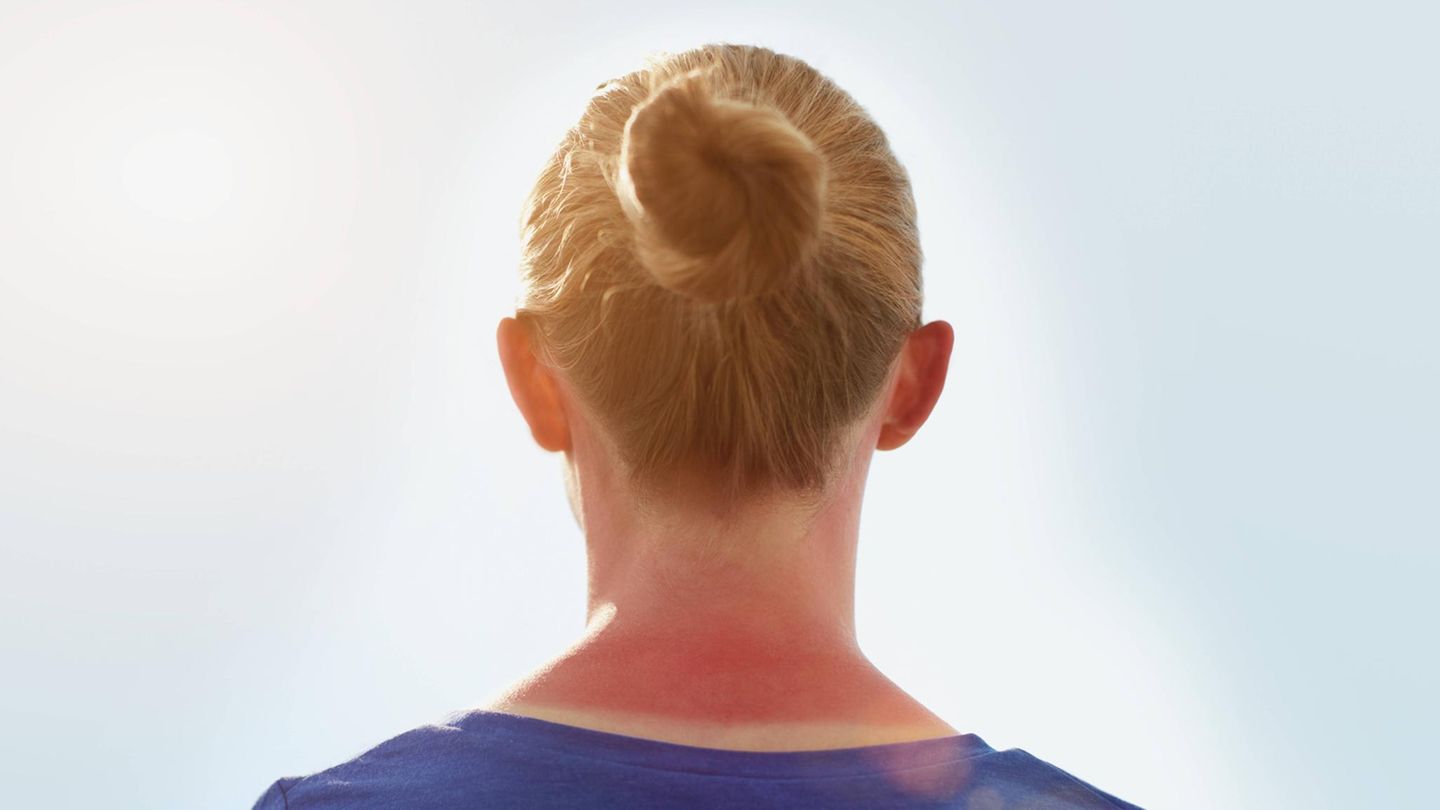 Mythen-Check: Sieben populäre Irrtümer, die zu Hautkrebs führen können