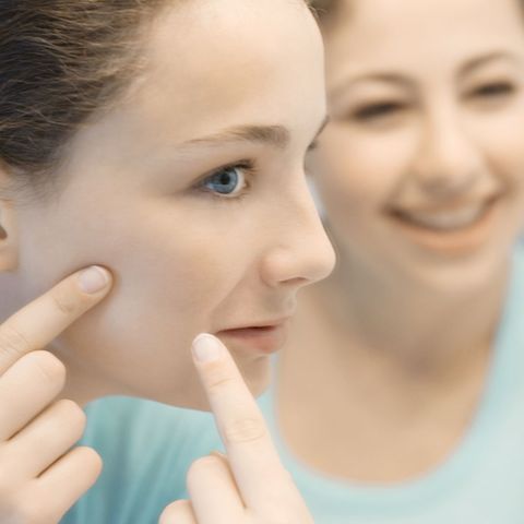 Jugendliche sind besonders häufig von Hautunreinheiten betroffen