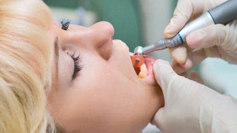 Laut Stiftung Warentest sollte eine professionelle Zahnreinigung sechs Schritte umfassen
