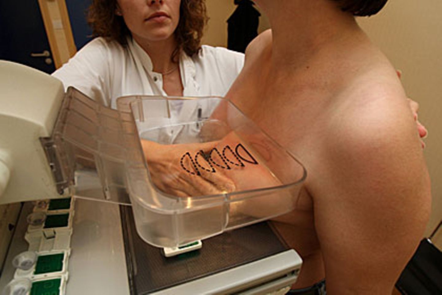 Nutzt das Mammographie-Screening? Dänische Wissenschaftler bezweifeln dies