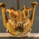 Auch Knochenfunde werden präsentiert. Dieser Kiefer wurde in Weymouth, Südengland, gefunden. Geschätztes Alter: zwischen 975 und 1025 nach Christus.