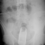 Was das ist? Ein Deoroller!