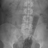 Das ist kein Mikrofon, sondern um eine Spritzflache.