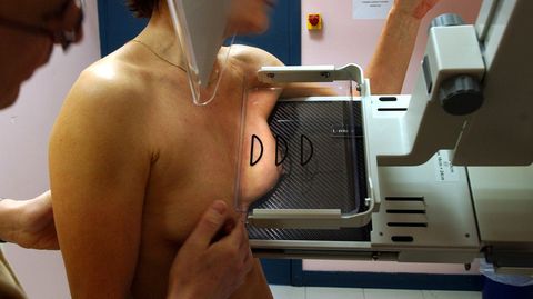 Am Nutzen der Reihenuntersuchung gibt es bereits seit einiger Zeit Zweifel.