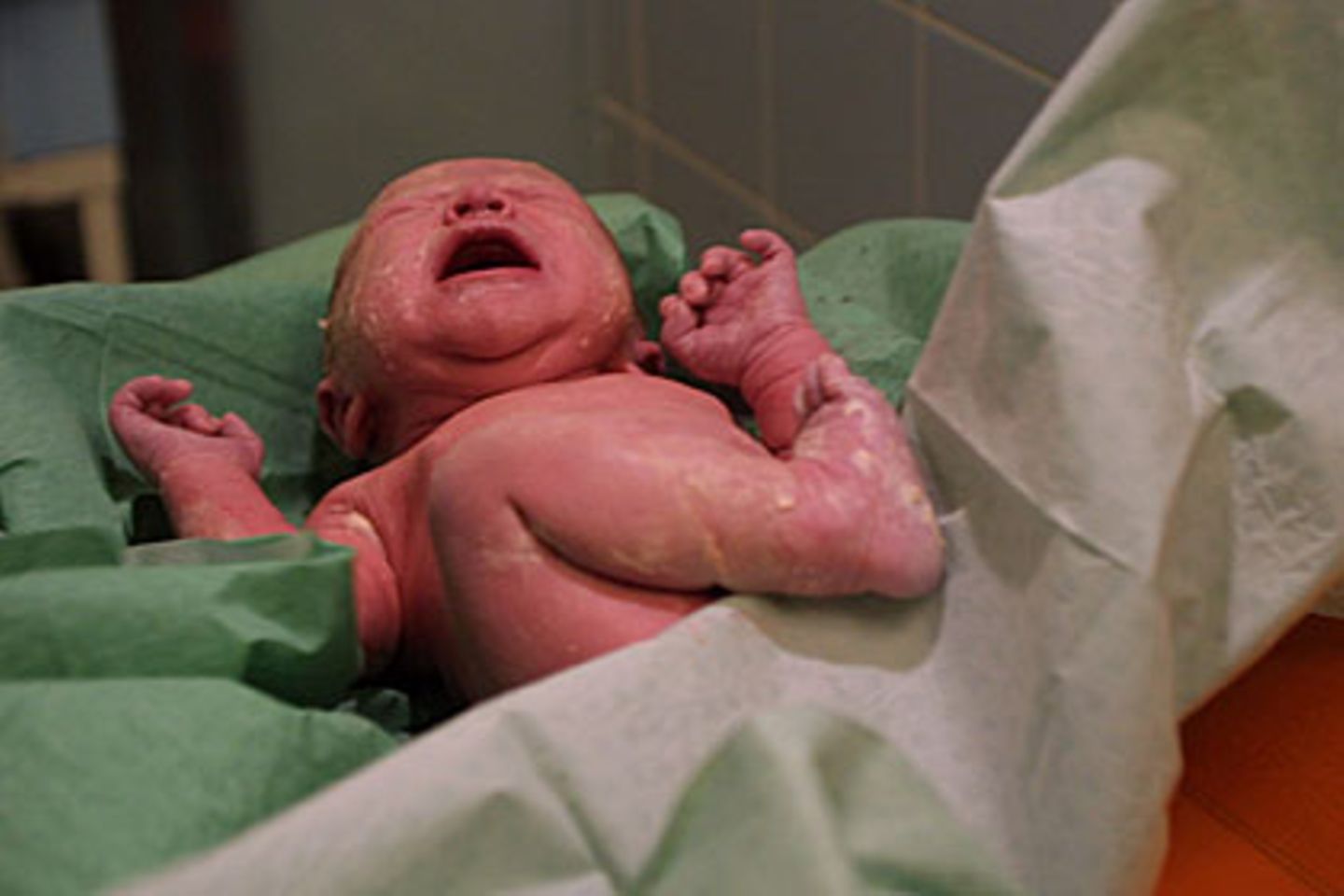 Bei Kindern, die mit einem Kaiserschnitt zur Welt kommen, besiedeln andere Bakterien kurz nach der Geburt die Haut und den Darm