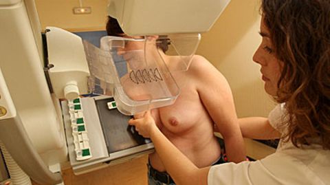 Frauen zwischen 50 und 69 können alle zwei Jahre am Mammografie-Screening teilnehmen
