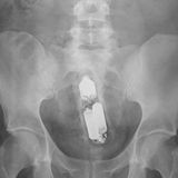 An den Batterien zu erkennen: ein Vibrator