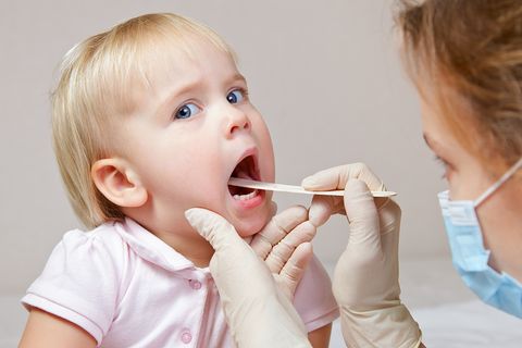 Im Jahr 2010 wurden in Deutschland insgesamt 69.000 Kindern und Jugendlichen die Gaumenmandeln entfernt.