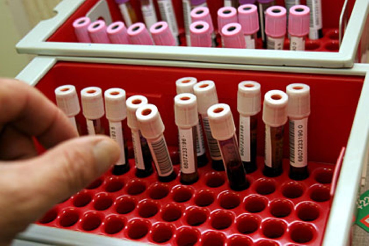 Der neue Bluttest verbessert die Krebsdiagnostik