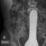 Hier hat sich ein Riesendildo verhakt.