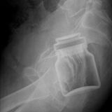 Unglaublich aber wahr, hier hängt eine Kaffeedose fest.