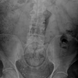 Hier zeichnen sich die Umrisse einer Orange ab.