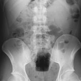 Hier ist der Boden einer Flasche erkennbar.