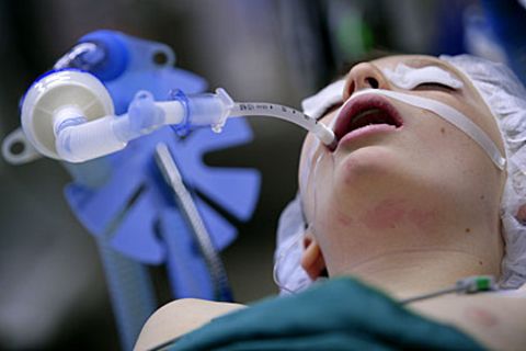 Innerhalb weniger Stunden kann eine Sepsis lebenswichtige Organe schädigen
