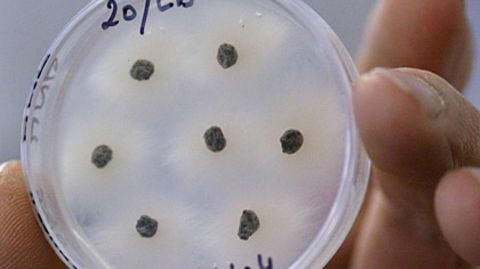 Im Labor wird untersucht, ob ein Bakterienstamm gegen Antibiotika resistent ist
