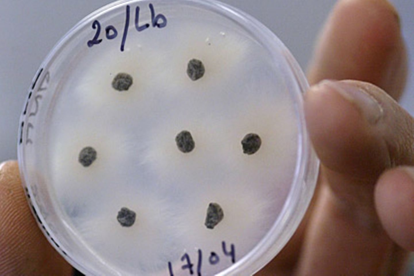 Im Labor wird untersucht, ob ein Bakterienstamm gegen Antibiotika resistent ist