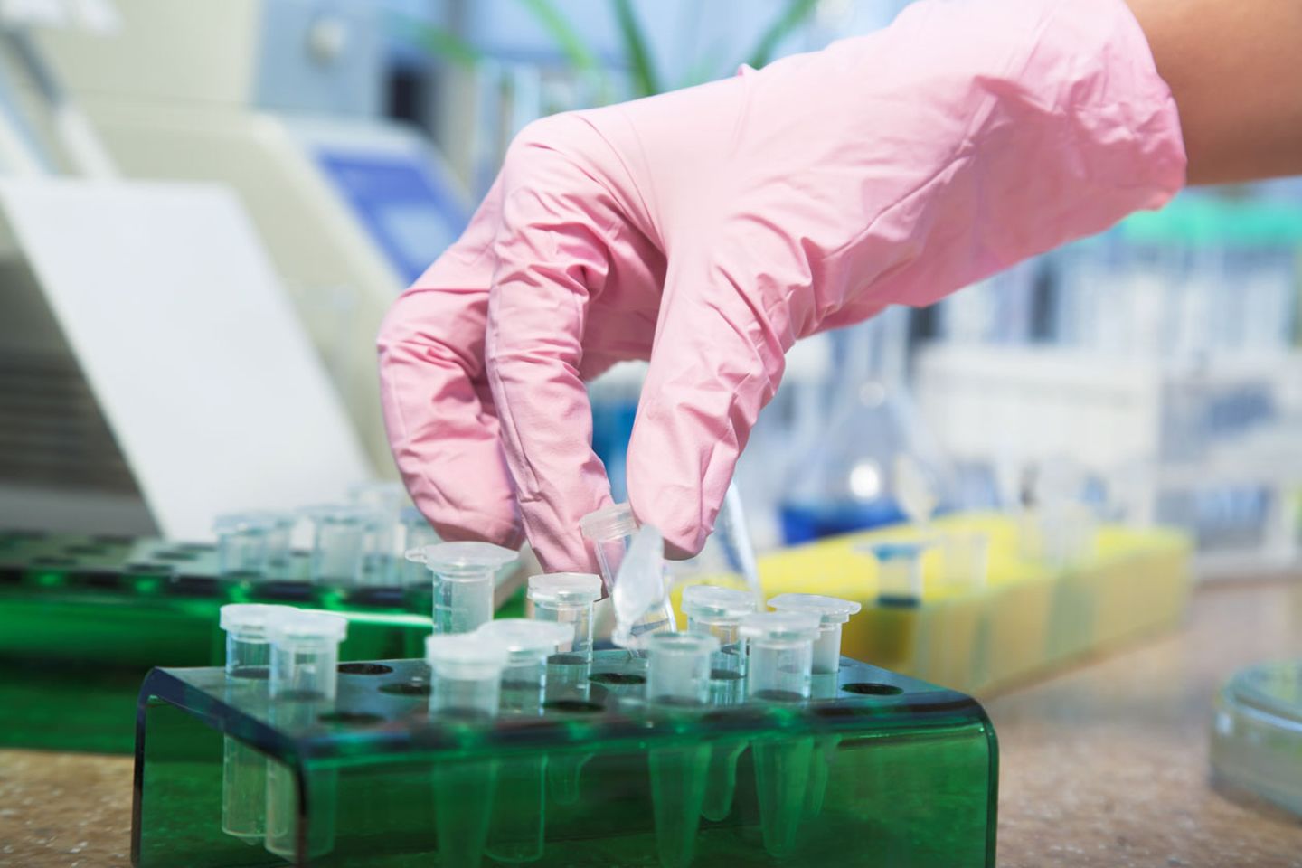 Risikopatienten sollen künftig bei Verdacht auf Schweinegrippe per DNA-Test überprüft werden