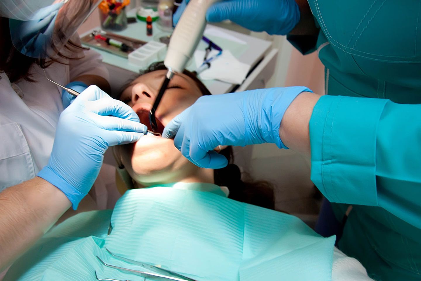 Entdeckt der Zahnarzt eine Zyste, rät er meist dazu, sie zu entfernen