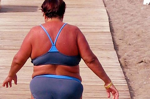 Nicht nur kosmetisches Problem: Starker Sonnenbrand kann sogar Fieber auslösen