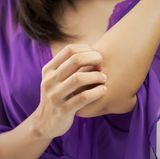 Reiben, zwicken oder beklopfen Sie juckende Hautstellen, statt sie zu kratzen