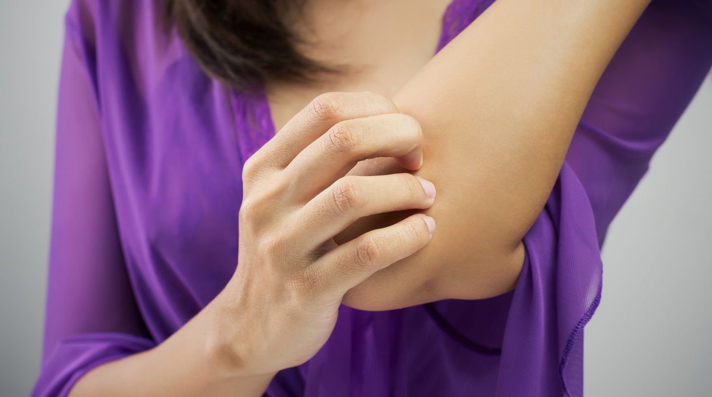 Reiben, zwicken oder beklopfen Sie juckende Hautstellen, statt sie zu kratzen