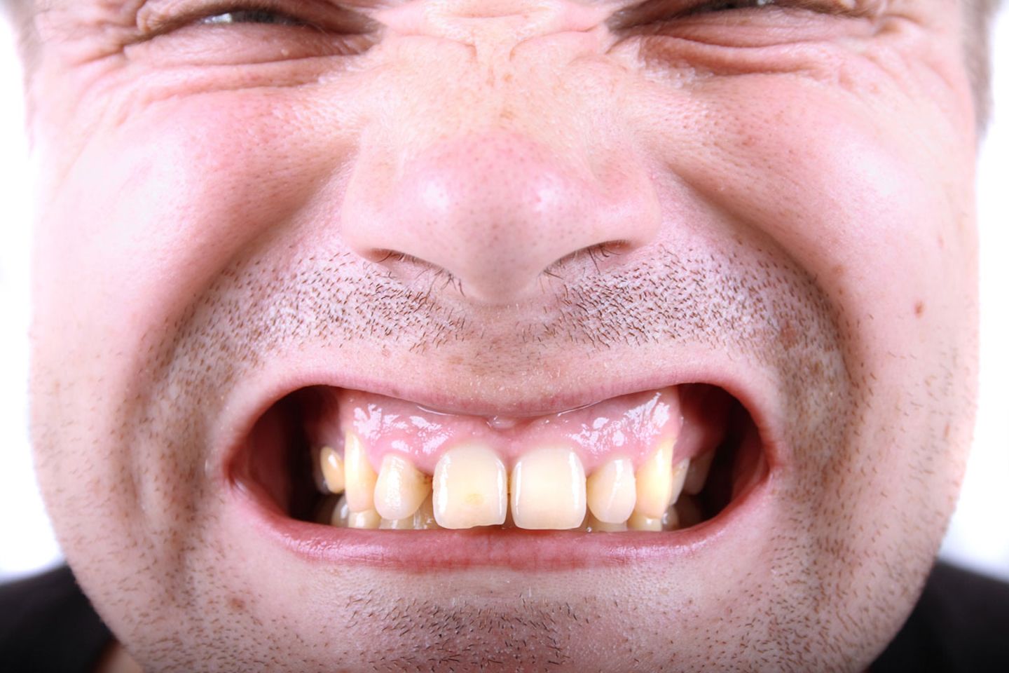 Greifen die Zähne gut ineinander, ist alles in Ordnung