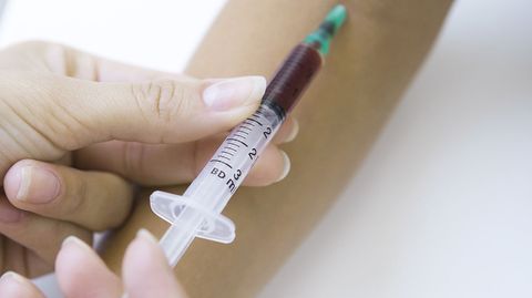 Beim IgE-Bluttest untersucht der Arzt die Menge bestimmter Antikörper