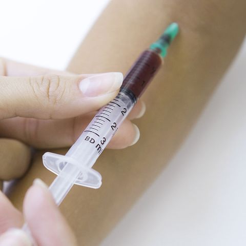 Beim IgE-Bluttest untersucht der Arzt die Menge bestimmter Antikörper