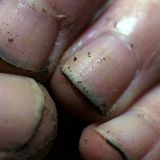 Wer zu spät kommt, den bestraft der Vorgesetzte     Ein wütender Chef hat in Kambodscha einem Mechaniker Daumen und Zehen abgehackt, weil er wegen einer Hochzeitsfeier zu spät zur Arbeit gekommen ist. Kim Ne hatte nach Angaben der Polizei ein Moped ausgeliehen und war zu der Hochzeit gefahren. Der 22-Jährige brachte das Moped aber später zurück als geplant. "Nach Angaben von Ne befahl sein Chef zwei anderen Mitarbeitern, ihn festzuhalten und hackte dann nacheinander die Daumen und die großen Zehen ab", sagte der Polizeisprecher. Sein Fazit: "Nun kann er nicht mehr Moped fahren."