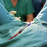 Auch Abtreibung steht auf der neuen Sünden-Liste des Vatikan. Traditionell umfasste die Liste der Hauptlaster Hochmut, Geiz, Neid, Zorn, Wollust, Völlerei und Faulheit. Damit eine aus diesen Charaktereigenschaften entstehende Sünde schwerwiegend ist, muss sie mit vollem Bewusstsein und aus freiem Willen begangen sein