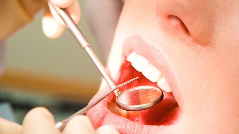 Mit Kratzern und Schabern werden Ihre Zähne vom Zahnstein befreit