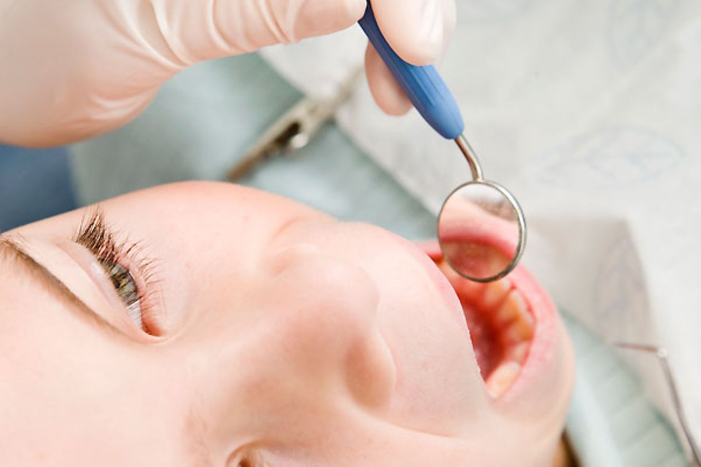 Gesetzlich Versicherte: Zahnersatz-Zusatzversicherung Brücken, Kronen, Implantate: Bei wem es im Gebiss bröckelt, für den wird es richtig teuer. Die gesetzlichen Kassen übernehmen nur noch maximal 65 Prozent der Kosten - die locker vierstellig werden können. Schon lange haben sich deshalb Zusatzversicherungen für Zahnersatz etabliert, die im Notfall einspringen. Zwischen fünf und zwanzig Euro im Monat kosten diese Versicherungen in der Regel. Verbraucherschützer halten sie für die wichtigste und lohnendste Zusatz-Absicherung Zahnersatz-Zusatzversicherung Brücken, Kronen, Implantate: Bei wem es im Gebiss bröckelt, für den wird es richtig teuer. Die gesetzlichen Kassen übernehmen nur noch maximal 65 Prozent der Kosten - die locker vierstellig werden können. Schon lange haben sich deshalb Zusatzversicherungen für Zahnersatz etabliert, die im Notfall einspringen. Zwischen fünf und zwanzig Euro im Monat kosten diese Versicherungen in der Regel. Verbraucherschützer halten sie für die wichtigste und lohnendste Zusatz-Absicherung