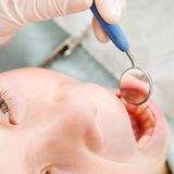 Zahnersatz-Zusatzversicherung    Brücken, Kronen, Implantate: Bei wem es im Gebiss bröckelt, für den wird es richtig teuer. Die gesetzlichen Kassen übernehmen nur noch maximal 65 Prozent der Kosten - die locker vierstellig werden können. Schon lange haben sich deshalb Zusatzversicherungen für Zahnersatz etabliert, die im Notfall einspringen. Zwischen fünf und zwanzig Euro im Monat kosten diese Versicherungen in der Regel. Verbraucherschützer halten sie für die wichtigste und lohnendste Zusatz-Absicherung