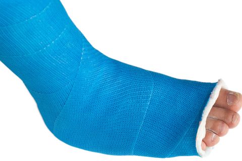 Osteoporose: Schon beim kleinsten Sturz droht ein Bruch