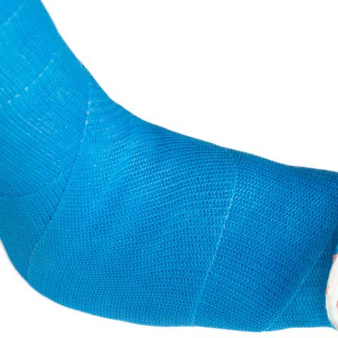 Osteoporose: Schon beim kleinsten Sturz droht ein Bruch